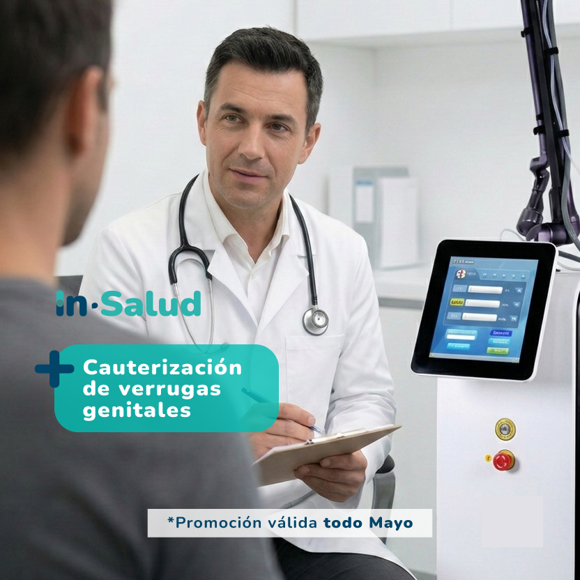 Cauterización de verrugas genitales